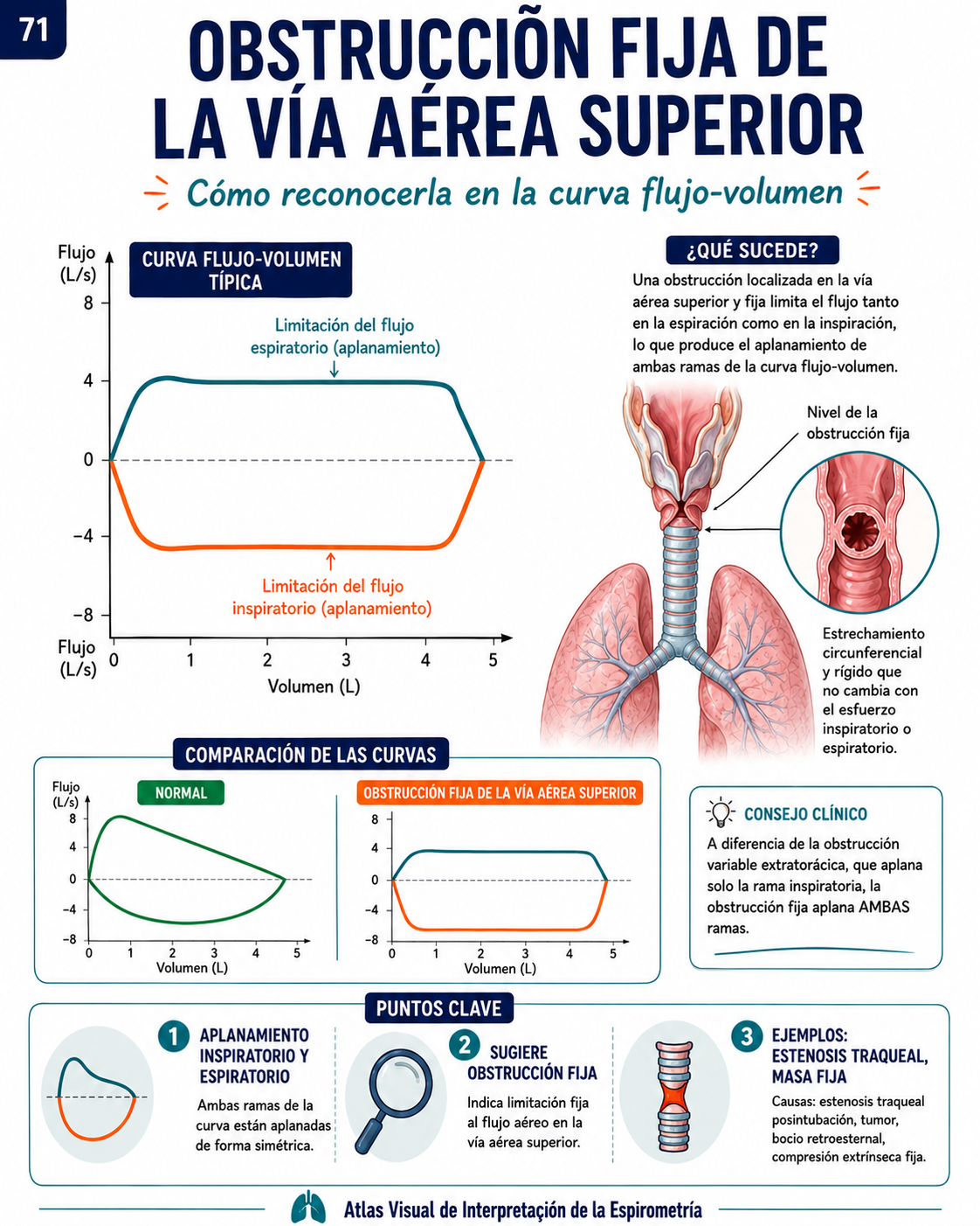 Muestra real del Atlas Visual de Interpretación de la Espirometría